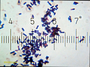 Lactobacillus acidophilus.jpg